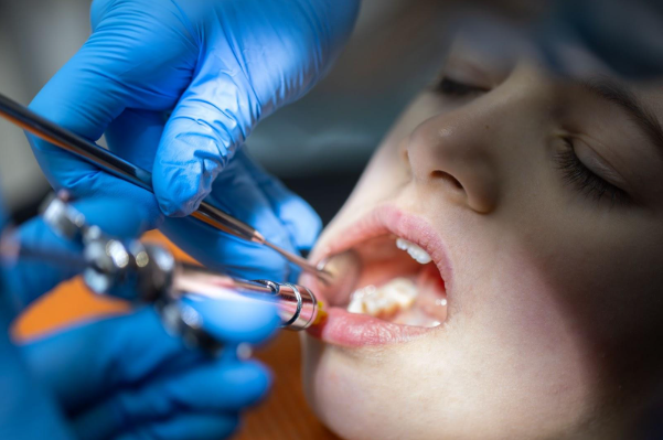Tooth-Treatment