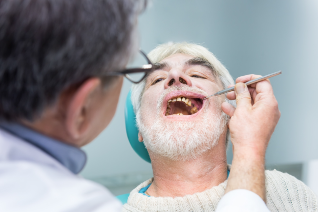 Dental Implant in Singapore: Types, Procedures and After Care